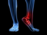What Factors Contribute to Tarsal Tunnel Syndrome?