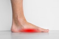 Living With Flat Feet