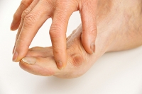 Are Bunions and Bunionettes the Same?